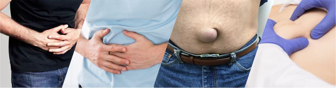 Best Hernia Ayurvedic Treatment, Medicines at DALCO Healthcare & Wellness Centre Near Me in Paschim Vihar, Delhi